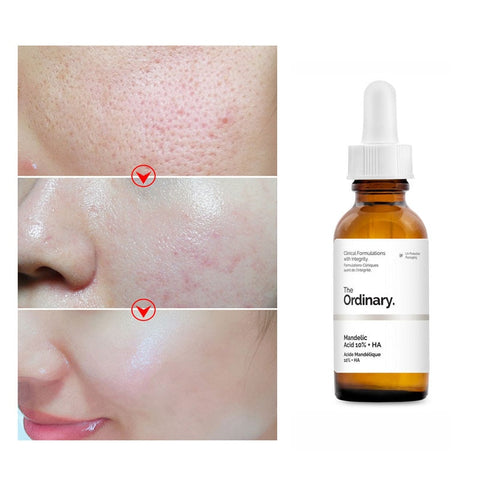 Image of Hyaluronic Acid Exfoliating Serum